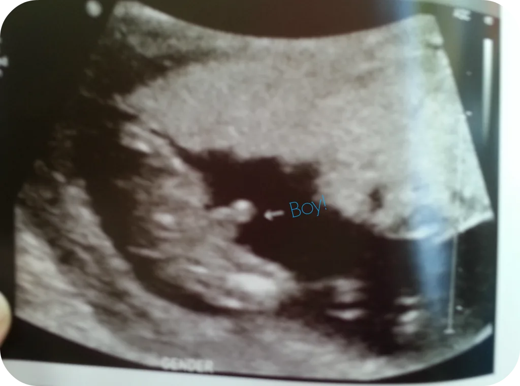 Boy Ultrasound 19 weeks